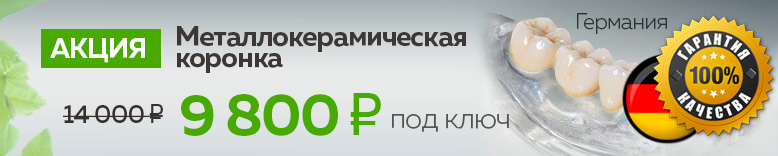 Металлокерамическая коронка цена в Москве под ключ 9800 руб - стоматология Лимон