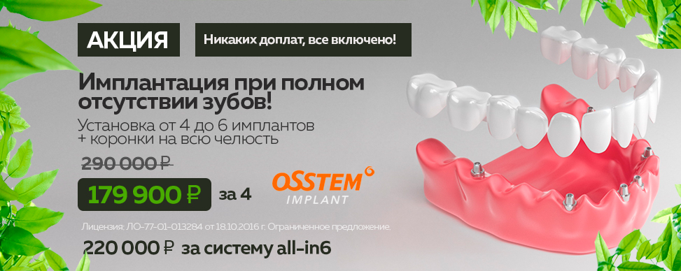 Имплантация при полной адентии зубов Osstem под ключ цена 179 900 рублей за одну челюсть в Москве