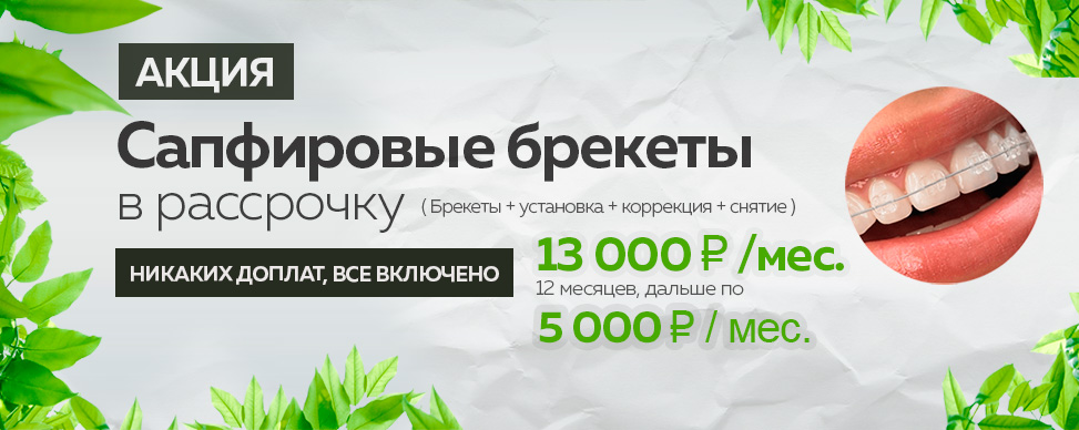Сапфировые брекеты в рассрочку 13000 руб за одну челюсть в Москве