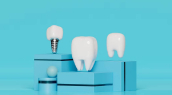 Имплантация зубов под ключ цена