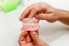 полное протезирование зубов на имплантах