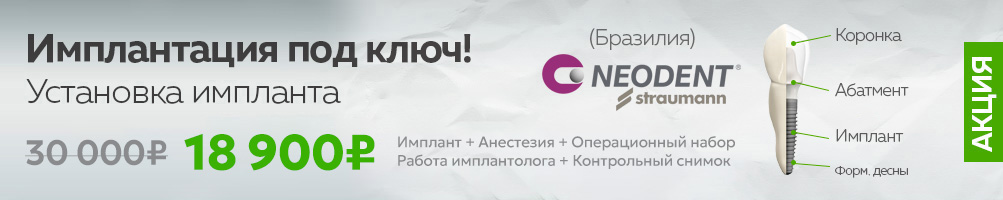 Имплантация зубов неодент под ключ акция - стоматология Лимон