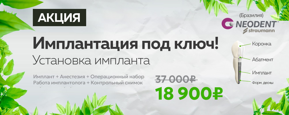имплантация зубов Neodent под ключ цена 44900 москва